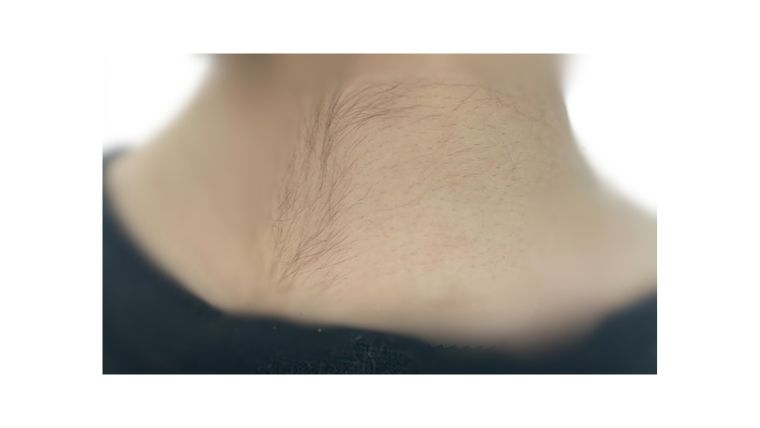 ボディシェーバーを使った様子画像